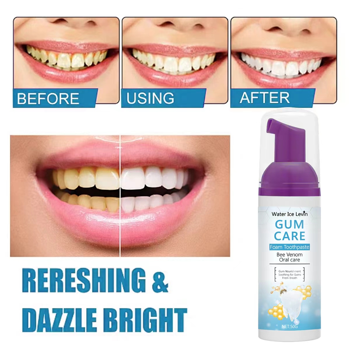 Water Ice Levin Gum Care Foam  - огляд і ціна Teeth Whitening Xylitol