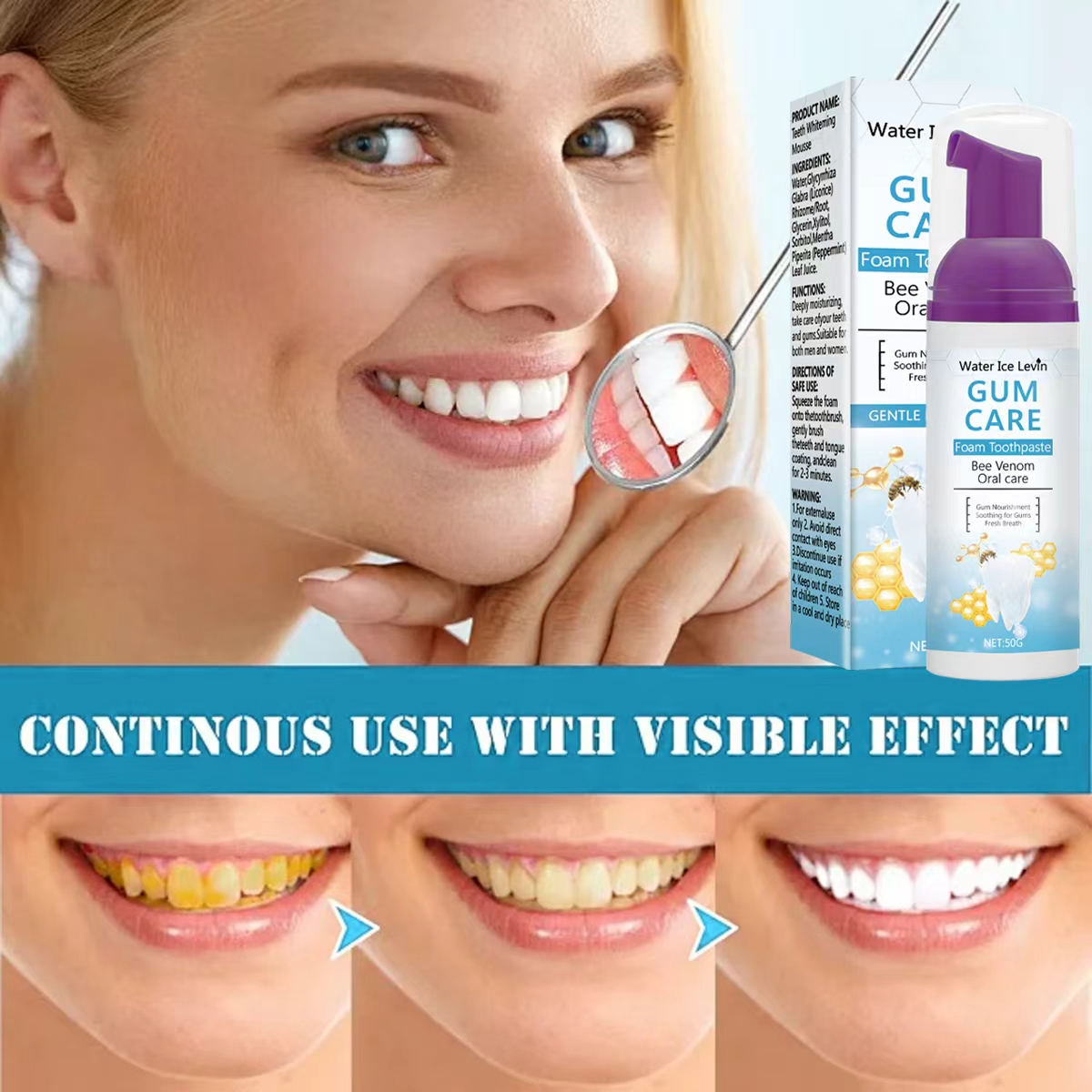 Water Ice Levin Gum Care Foam  - огляд і ціна Teeth Whitening Xylitol
