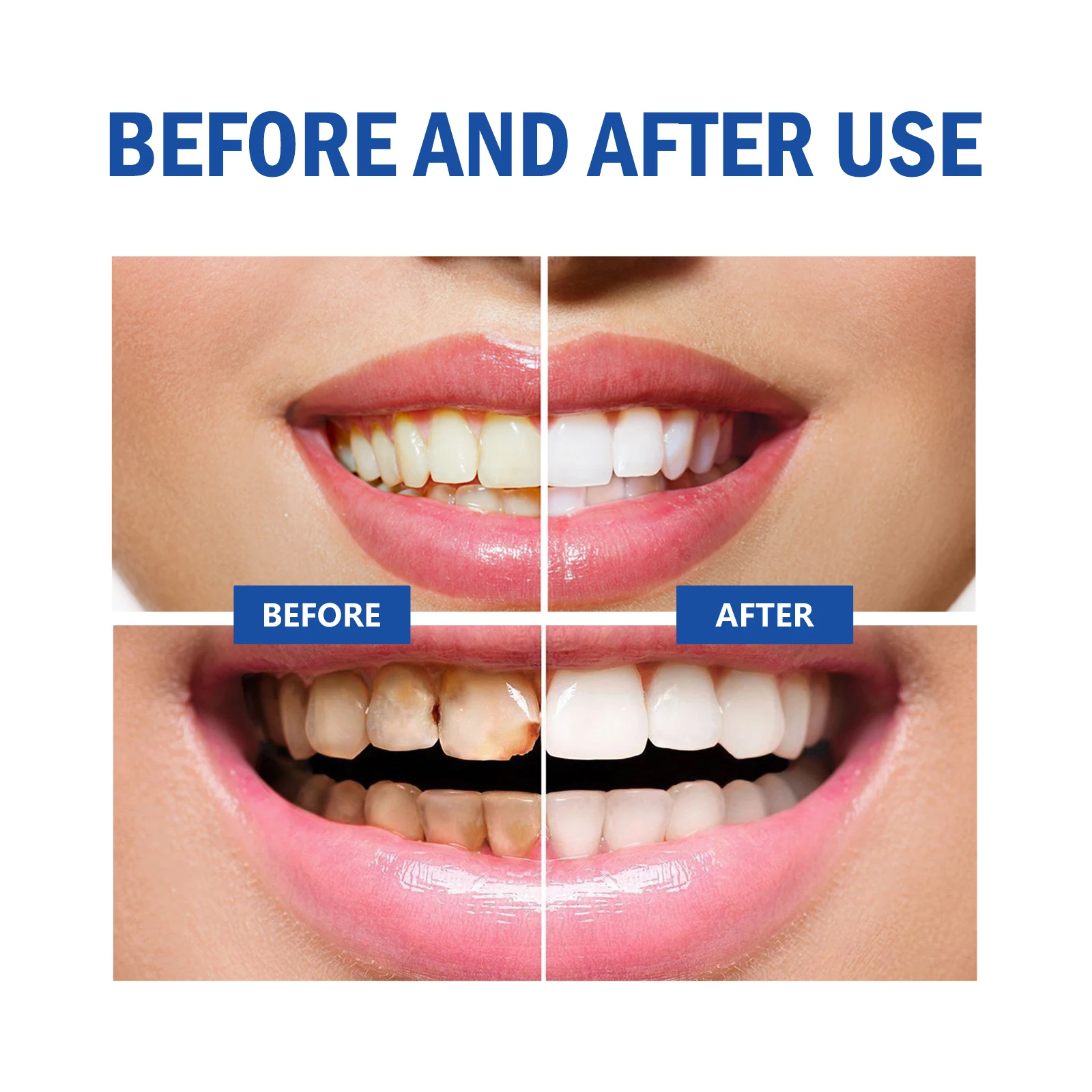 2pcs Gum Repair Gel Spray Deep - огляд і ціна Teeth Whitening Xylitol