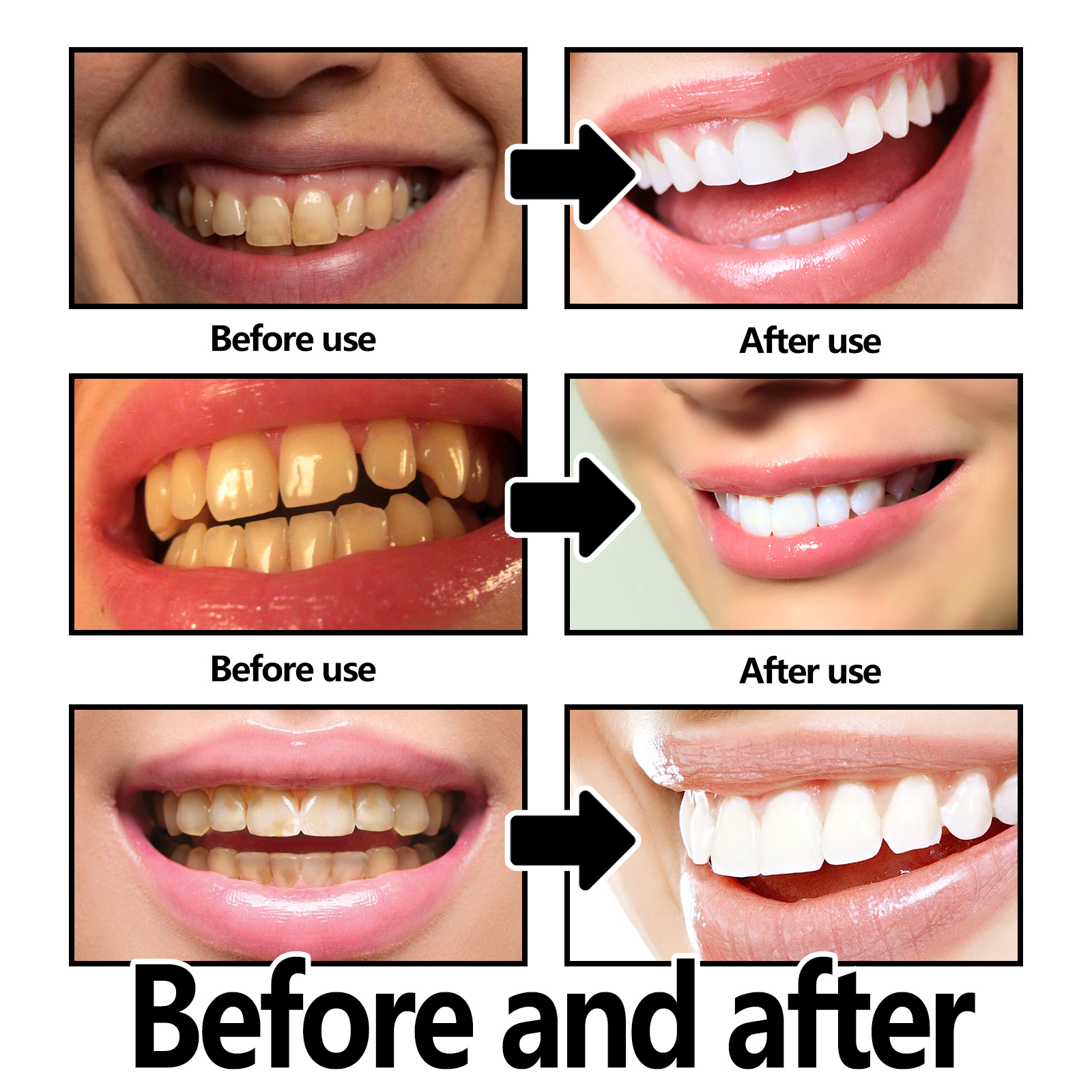 Xylitol Mint Purple Toothpaste - огляд і ціна Teeth Whitening Xylitol