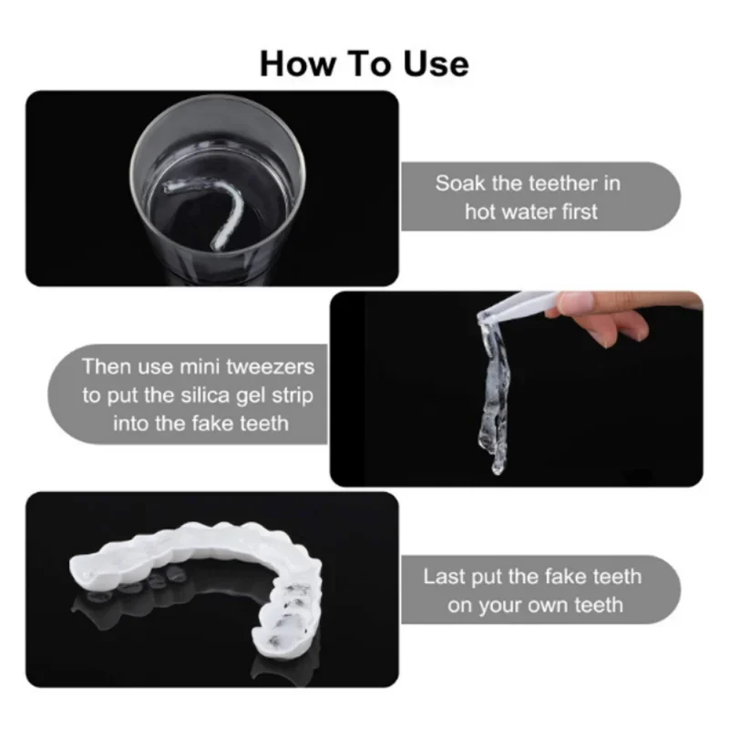 Denture Cover Veneer Snap-on T - огляд і ціна Teeth Whitening Session