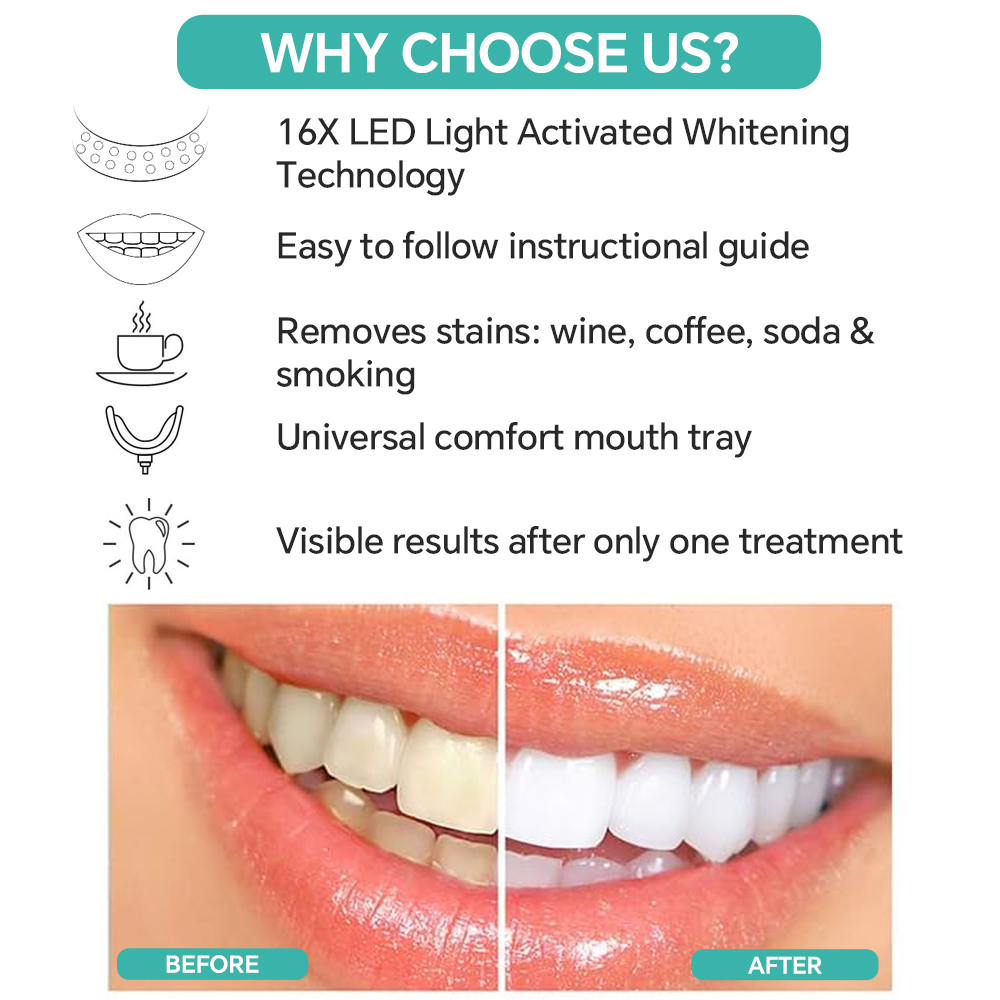 Teeth Whitening Accelerator Li - огляд і ціна Teeth Whitening Blue Light