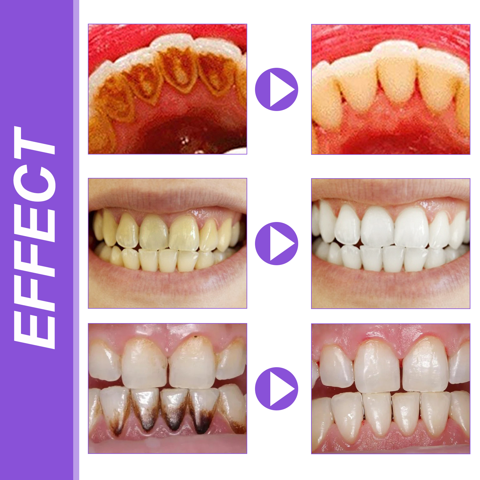 EELHOE Smiles Bright White Ref - огляд і ціна Teeth Whitening Xylitol