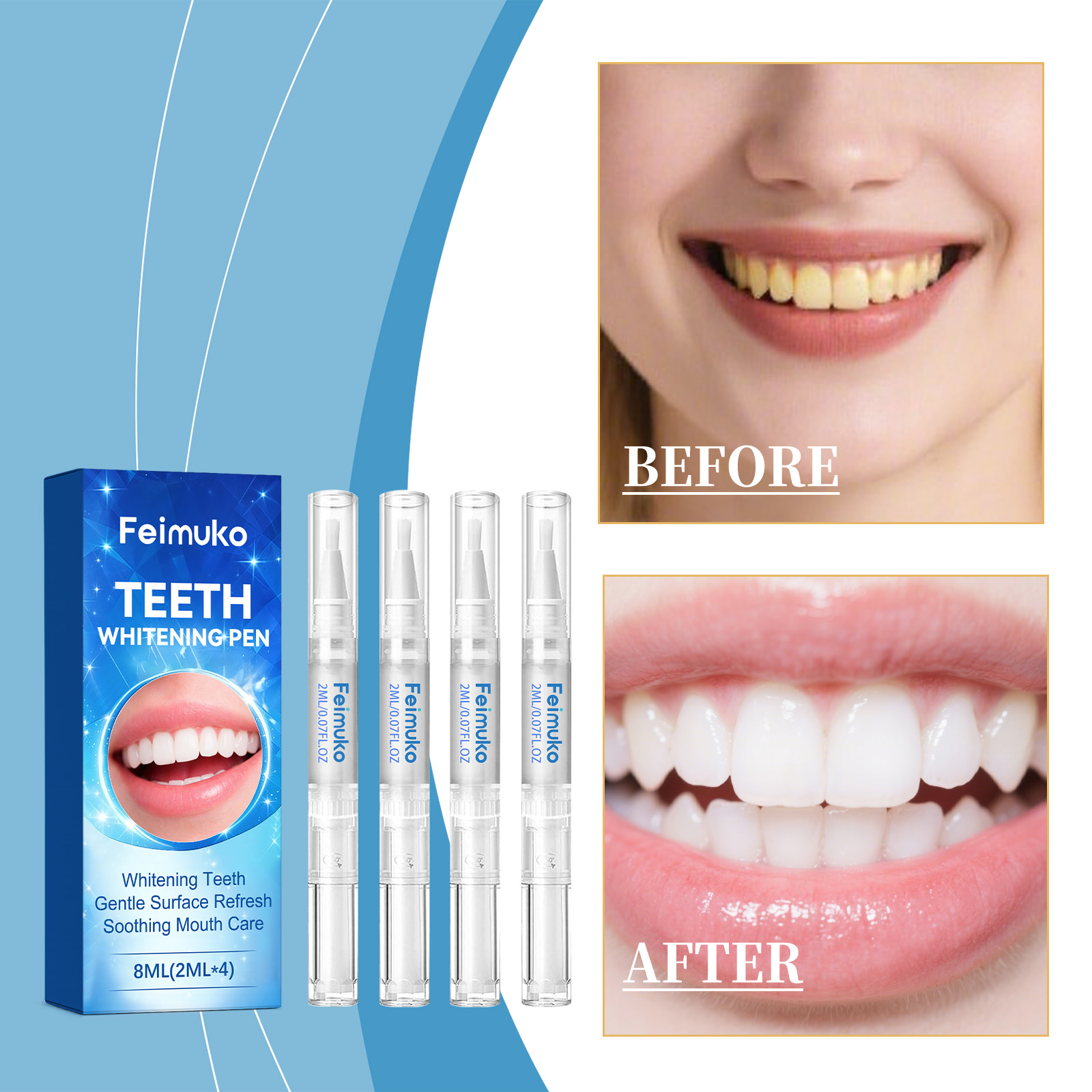 Feimuko 8ml Teeth Gel Pen Gent - огляд і ціна Teeth Whitening Gel