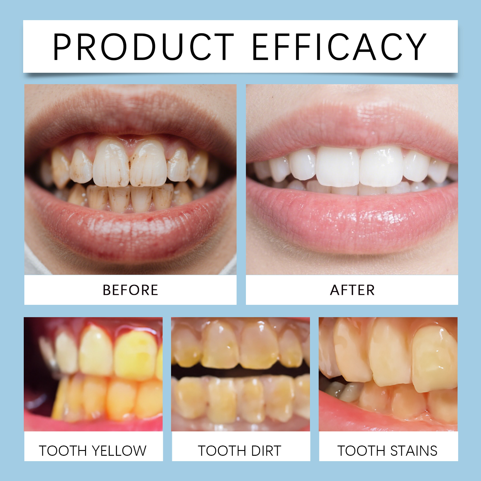 Feimuko 8ml Teeth Gel Pen Gent - огляд і ціна Teeth Whitening Gel