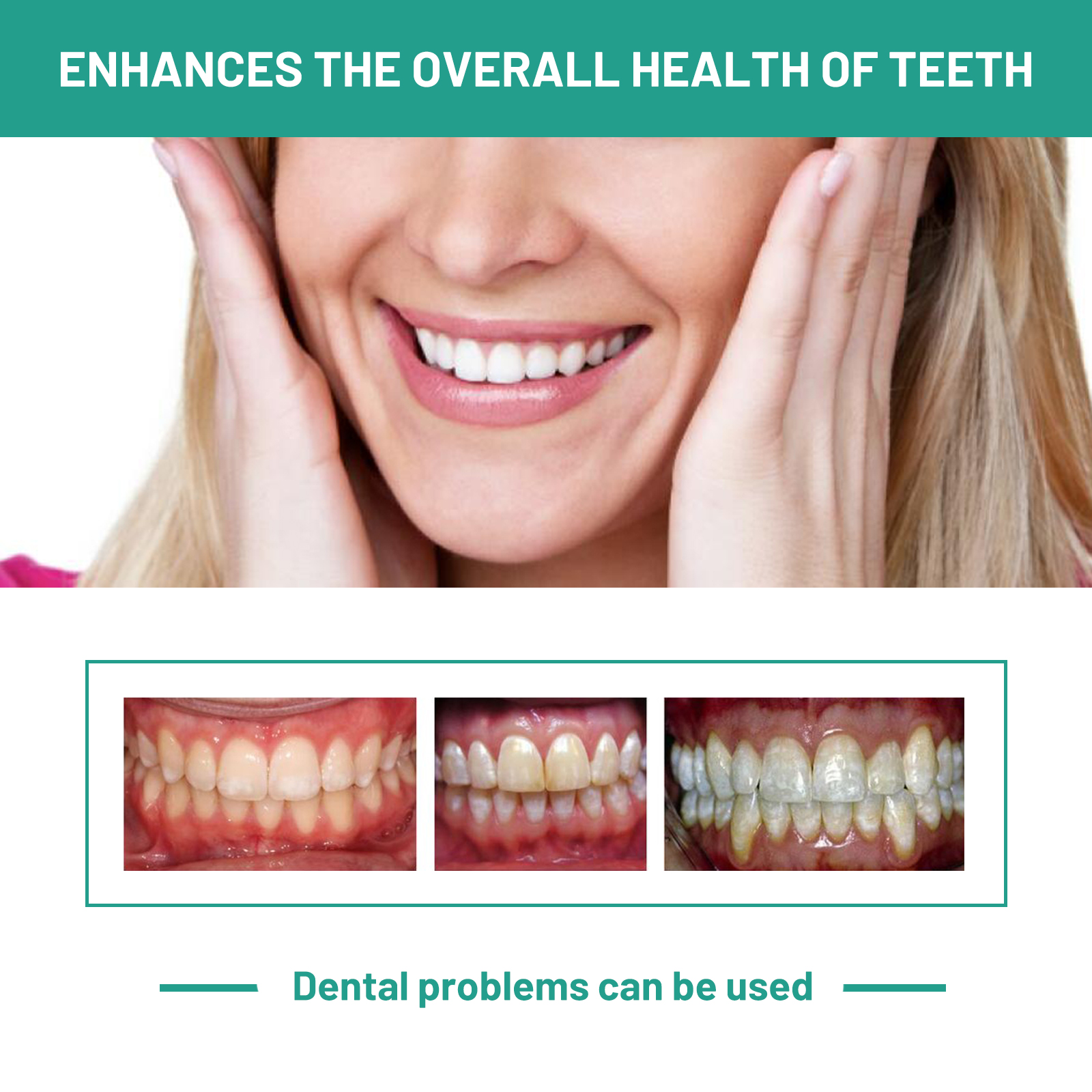 Probiotic Toothpaste Whiten To - огляд і ціна Teeth Whitening Xylitol