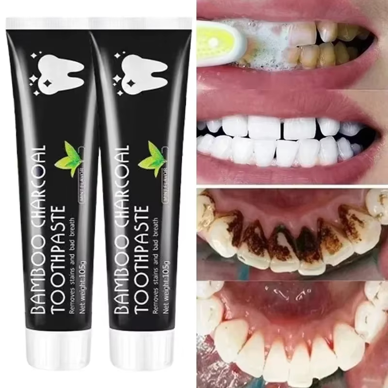 Whitening Toothpaste Bamboo Ch - огляд і ціна Teeth Whitening Remedies