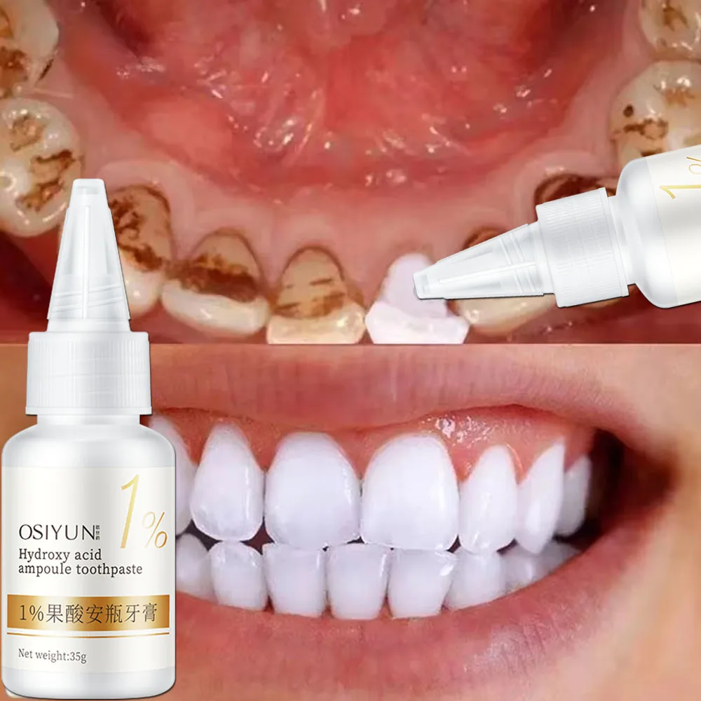 Teeth Whitening Toothpaste Fru - огляд і ціна Teeth Whitening Xylitol
