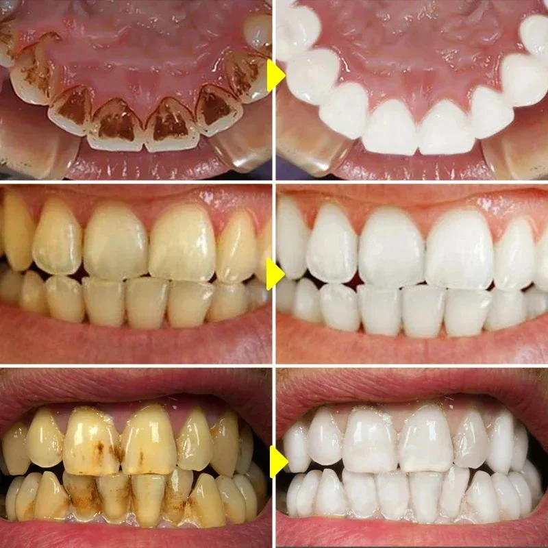 Teeth Whitening Toothpaste Fru - огляд і ціна Teeth Whitening Xylitol