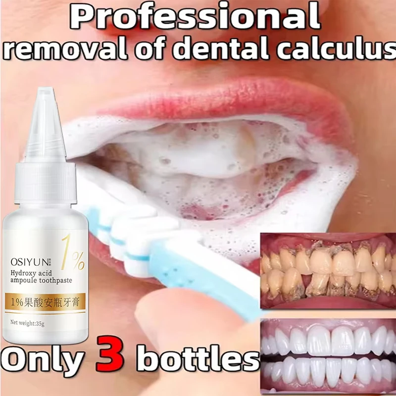 Teeth Whitening Toothpaste Fru - огляд і ціна Teeth Whitening Xylitol