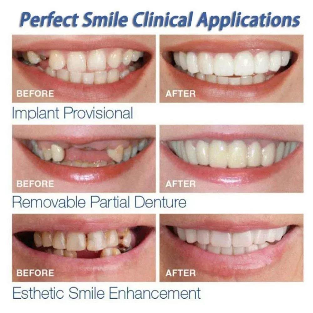 Best Sellers  Teeth Kit Fake T - огляд і ціна Teeth Whitening Session