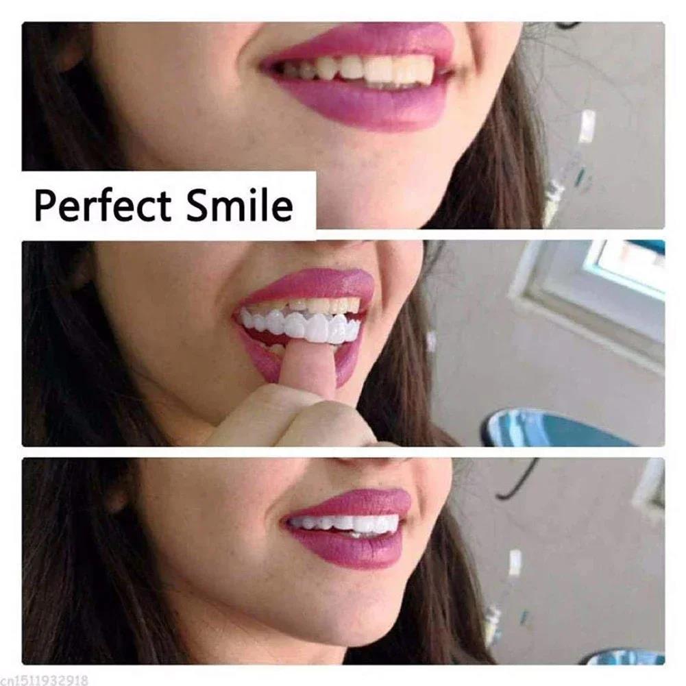 Best Sellers  Teeth Kit Fake T - огляд і ціна Teeth Whitening Session