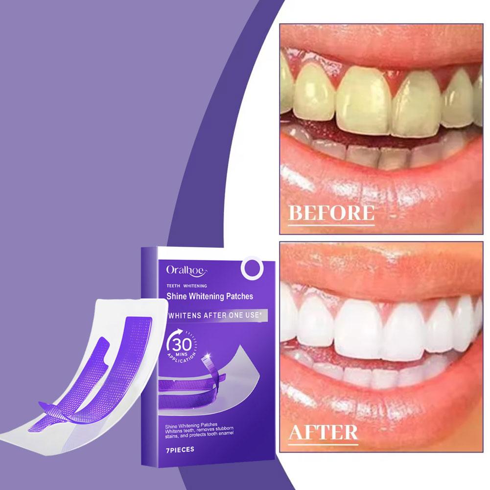 Purple Teeth Whitening Strips  - огляд і ціна Teeth Whitening/Bleaching