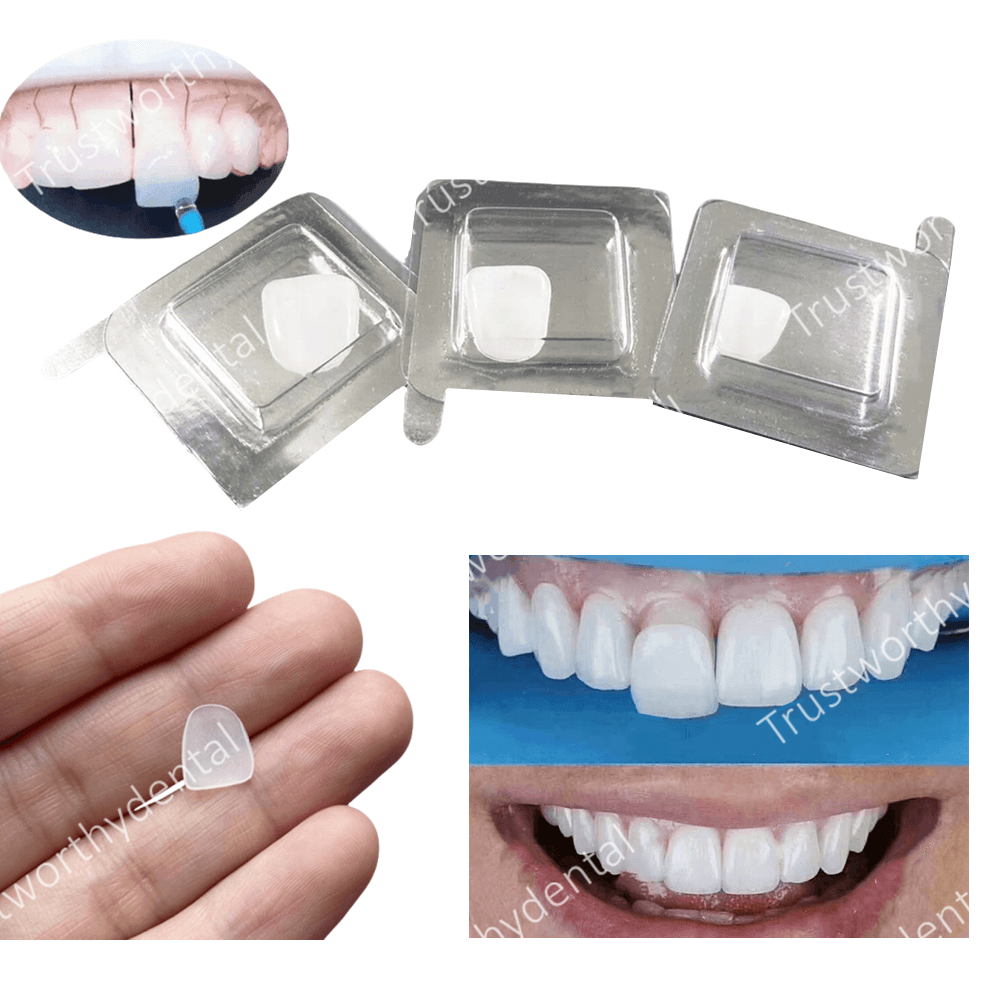 Dental Composite Porcelain Ven - огляд і ціна Teeth Paint Whitening