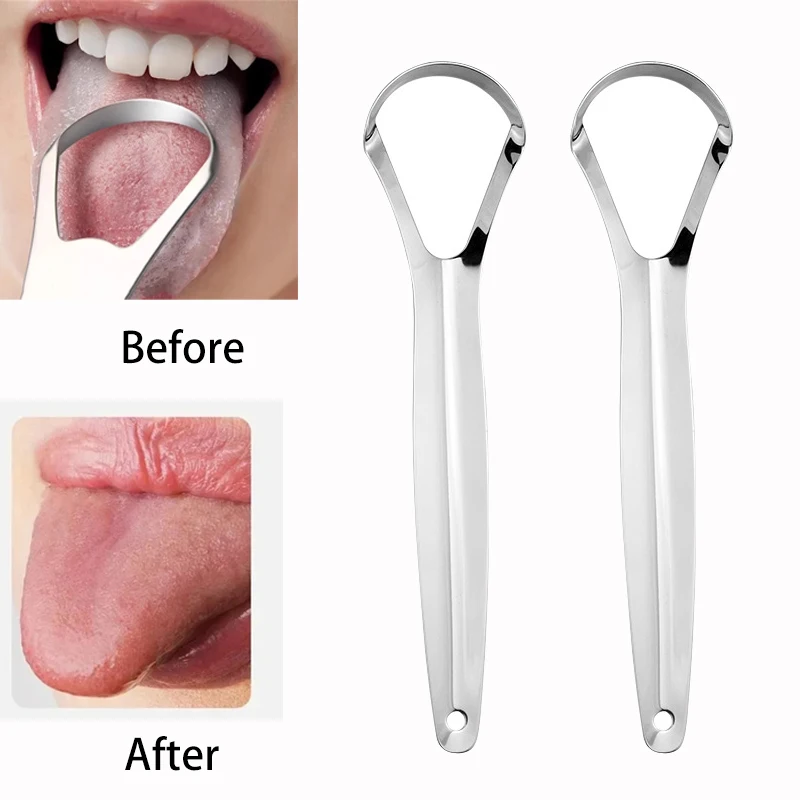 Halitosis Tongue Coating Tongu - огляд і ціна Tongue Scraper Metal