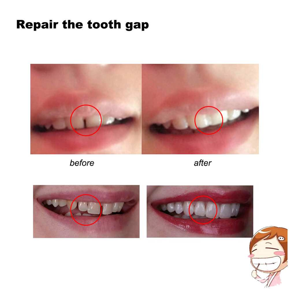 10/100g Dental Glue Handmade S - огляд і ціна Teeth Whitening Session