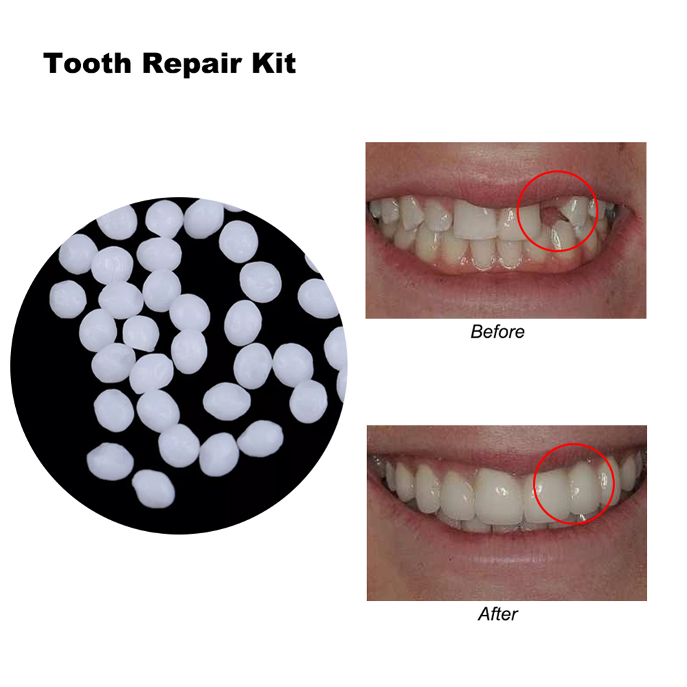 10/100g Dental Glue Handmade S - огляд і ціна Teeth Whitening Session