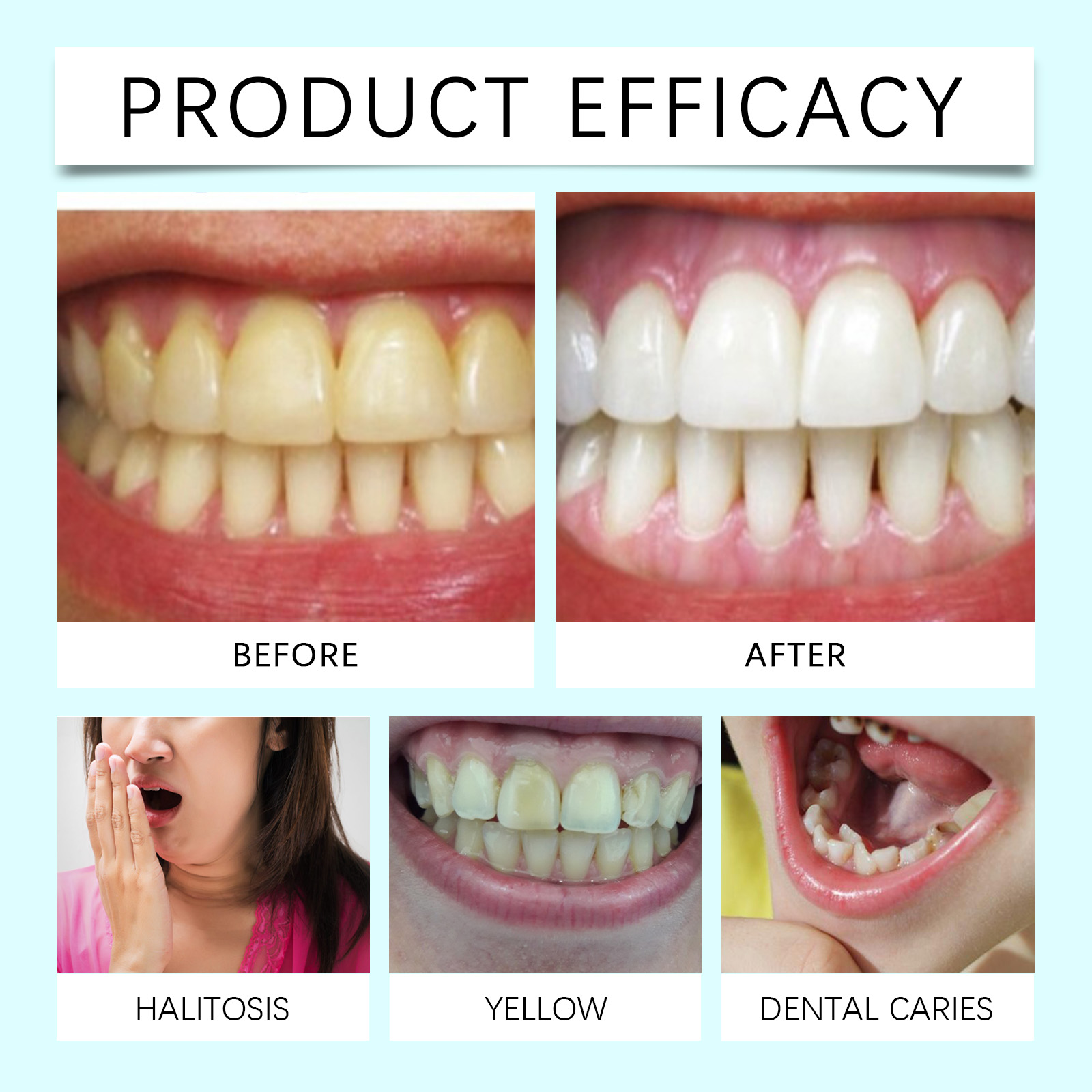 Tooth Whitening Strips Remove  - огляд і ціна Teeth Whitening Or Bleaching