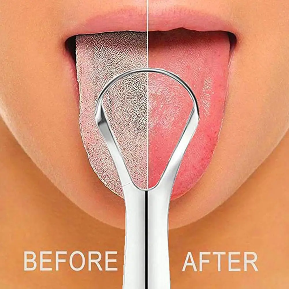 1-20pc Tongue Scraper, Stainle - огляд і ціна Tongue Scraper Metal