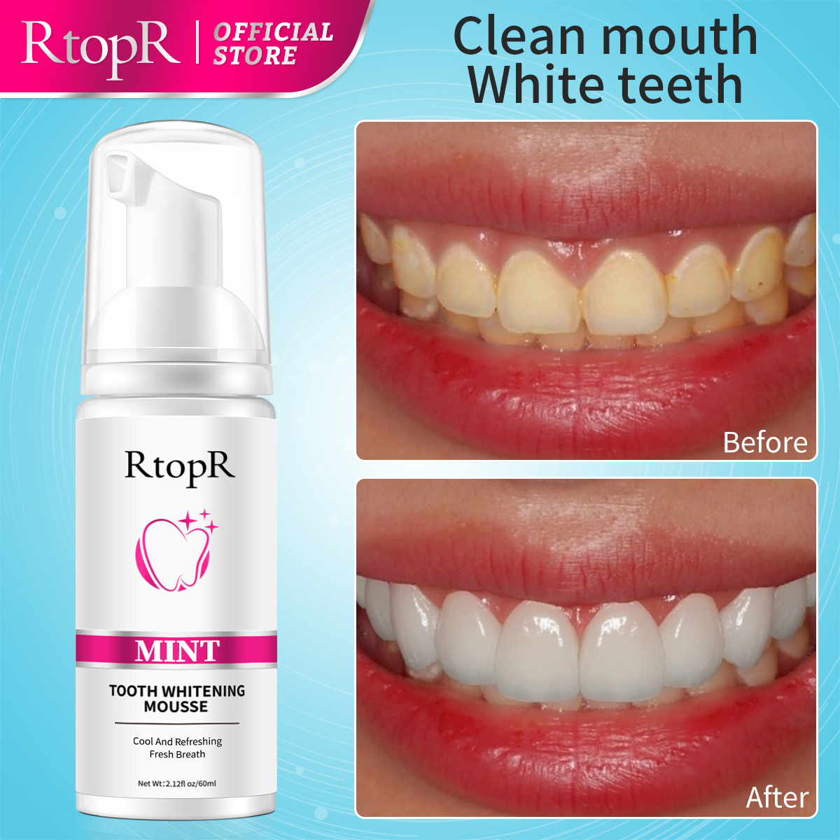 RtopR Mint Whitening Teeth Mou - огляд і ціна Teeth Whitening Xylitol