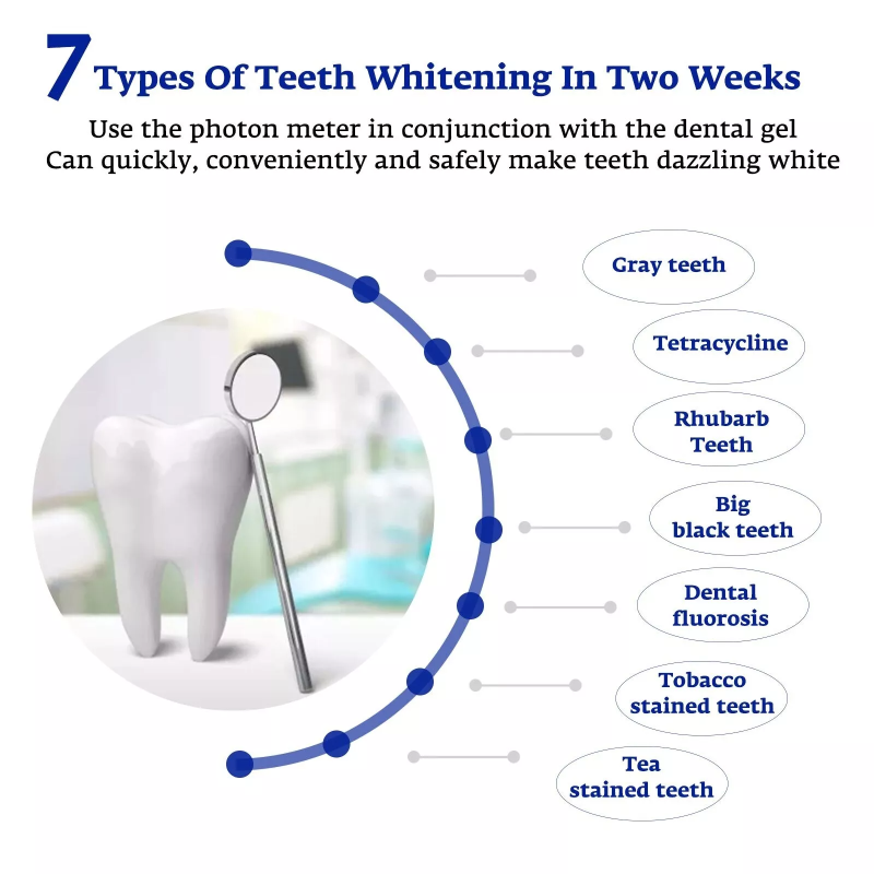 Teeth Whitening Accelerator Sm - огляд і ціна Teeth Whitening Blue Light