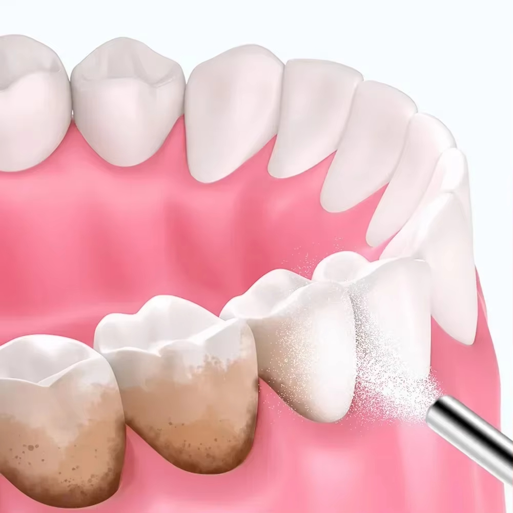 Dental Sandblasting Powder 500 - огляд і ціна Teeth Whitening Quotes